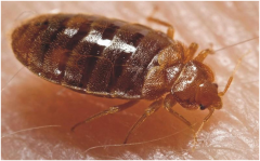 时代卫士为您支招怎么消灭臭虫